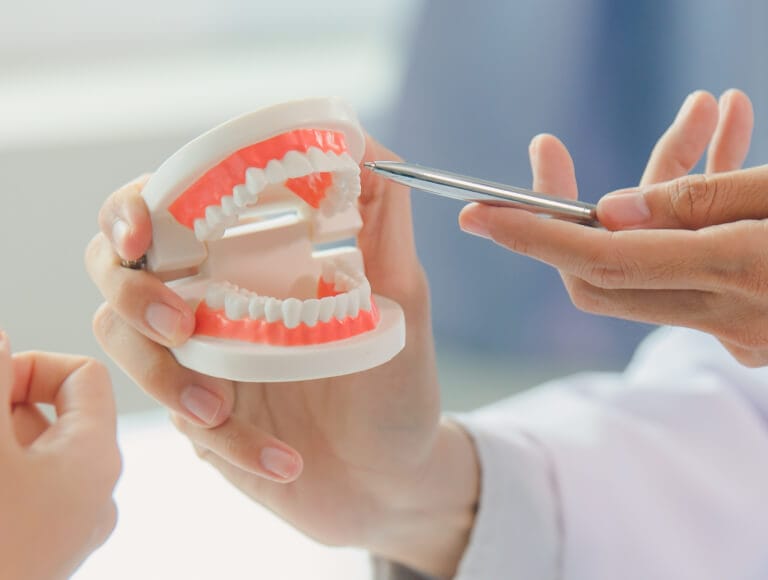 Benefits of Full-Mouth Dental Implants