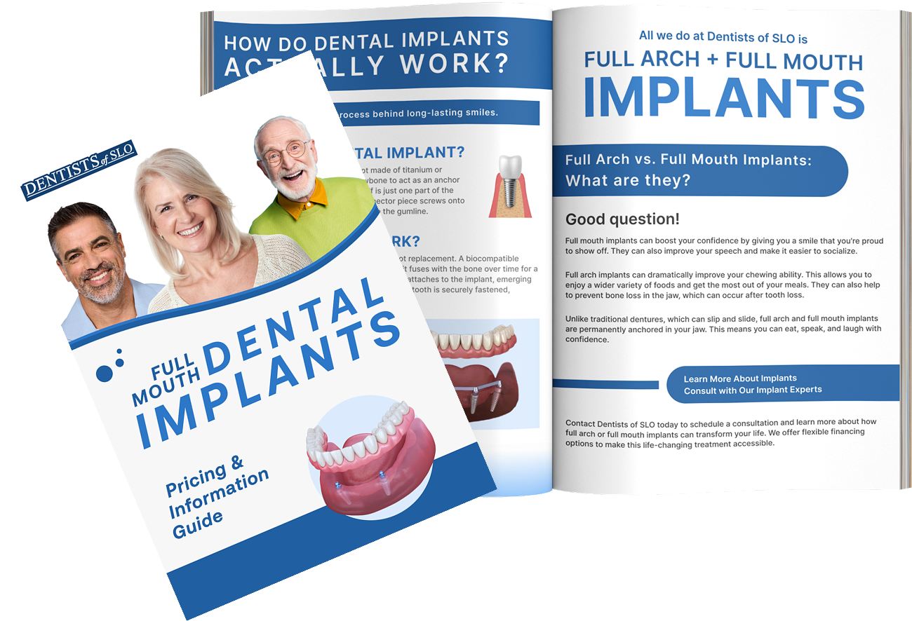 Dental Implant Pricing and Information Guide